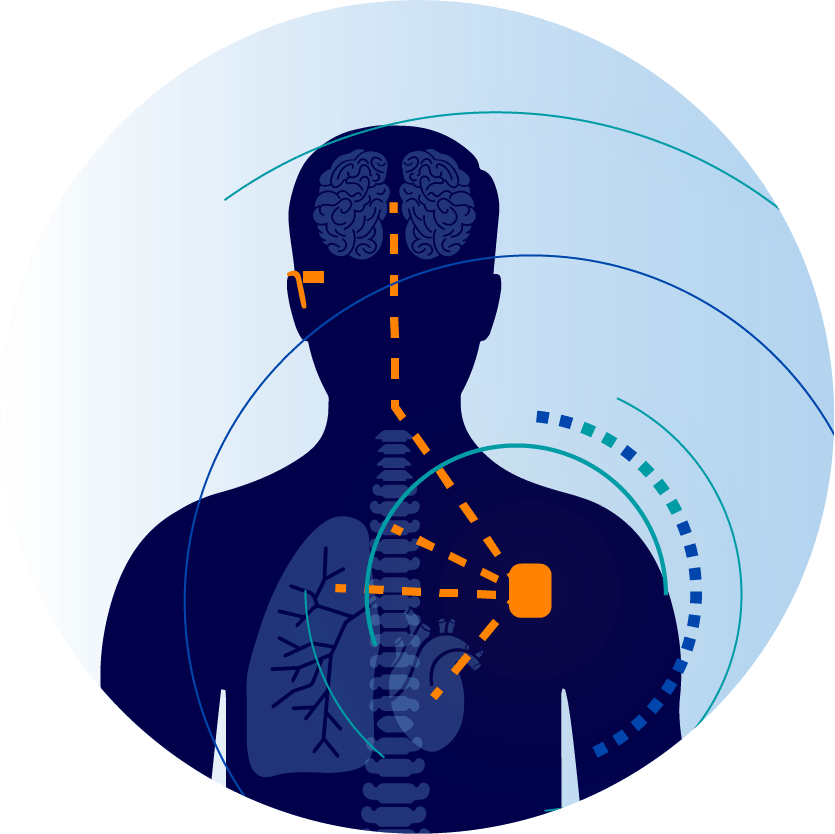 有源植入醫療器械